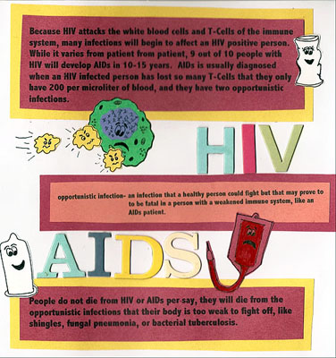 AIDS