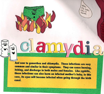 Chlamydia