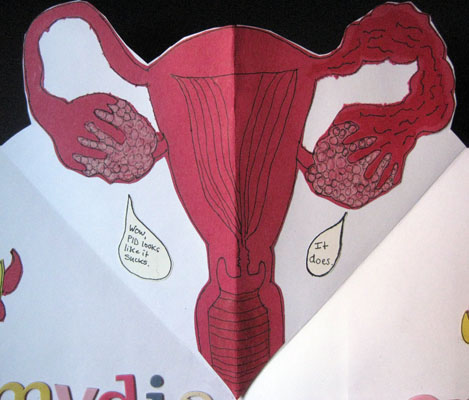 Infected Uterus